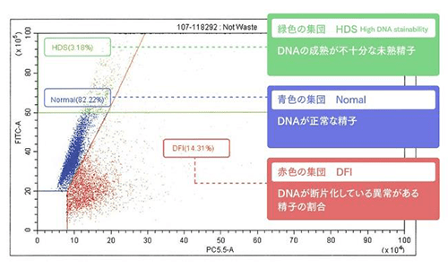 DFI検査
